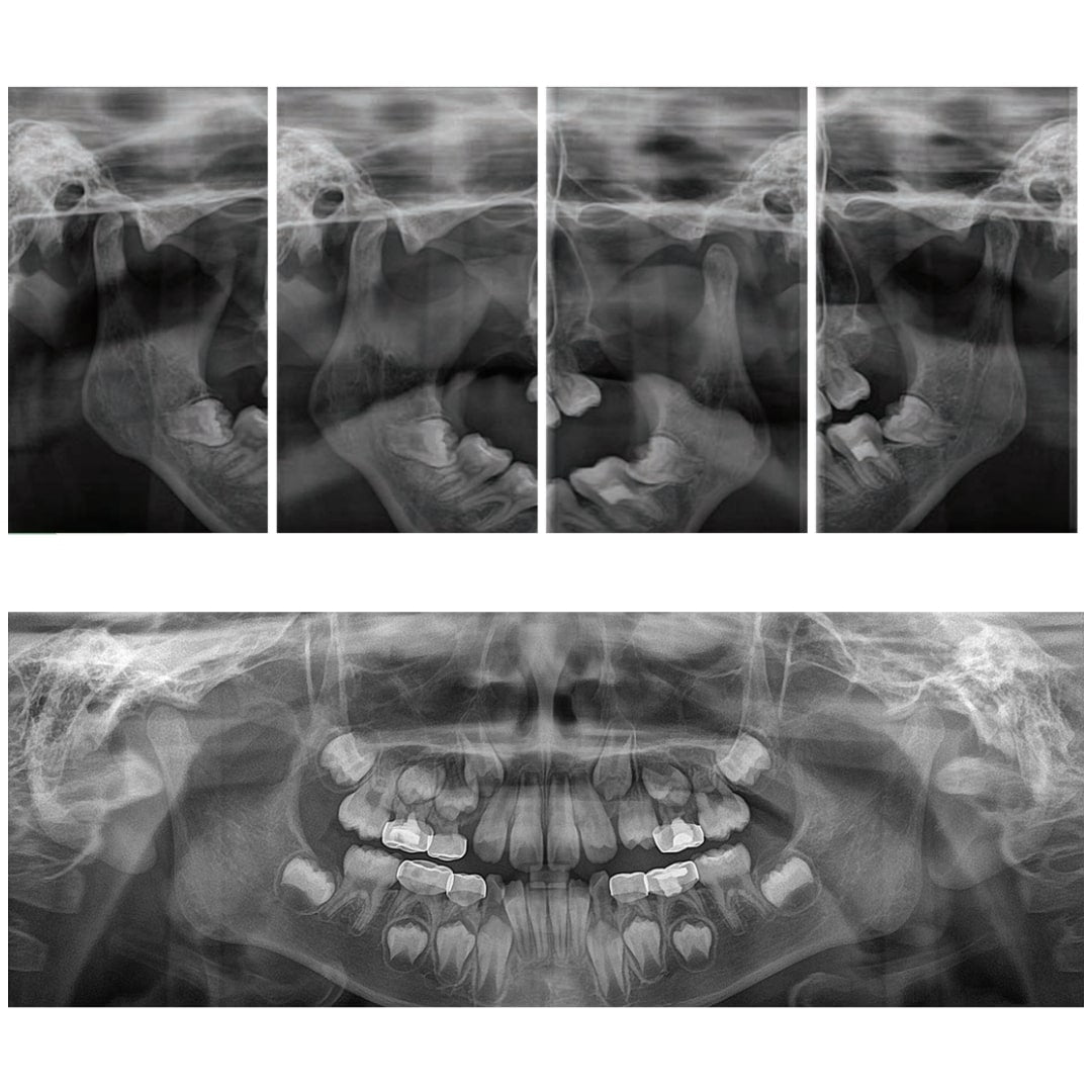 Aparat radiologie 2D/PANO Genoray Papaya